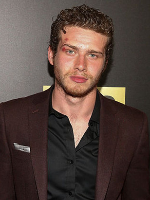 أوليفر ستارك