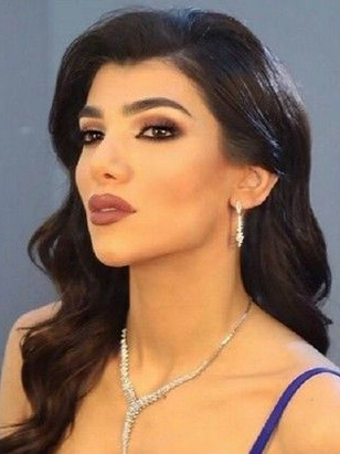 أنوار أبو حمدان