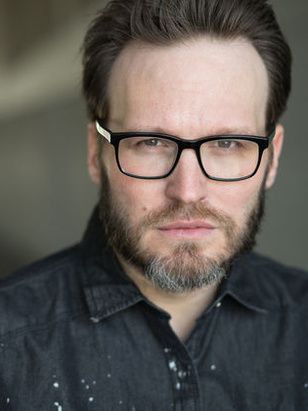 إيه جي سكالزي